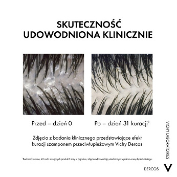 Vichy Dercos DS, szampon przeciwłupieżowy z odżywką 2w1, 390 ml