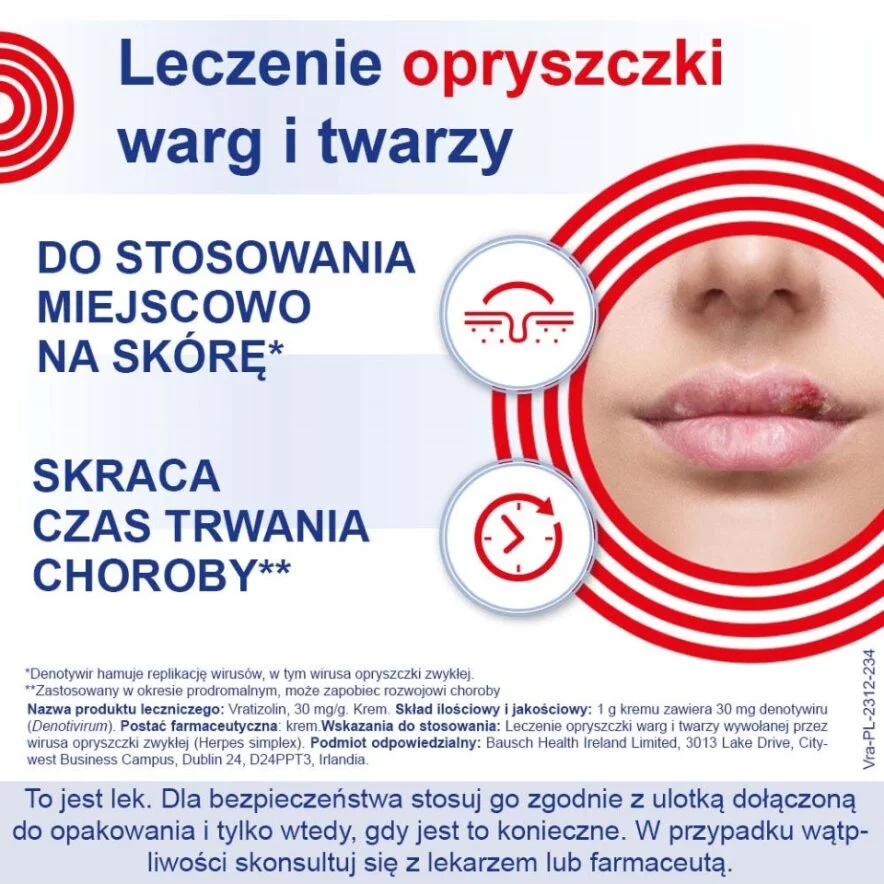 Vratizolin, krem stosowany na opryszczkę warg i twarzy, tuba 3 g