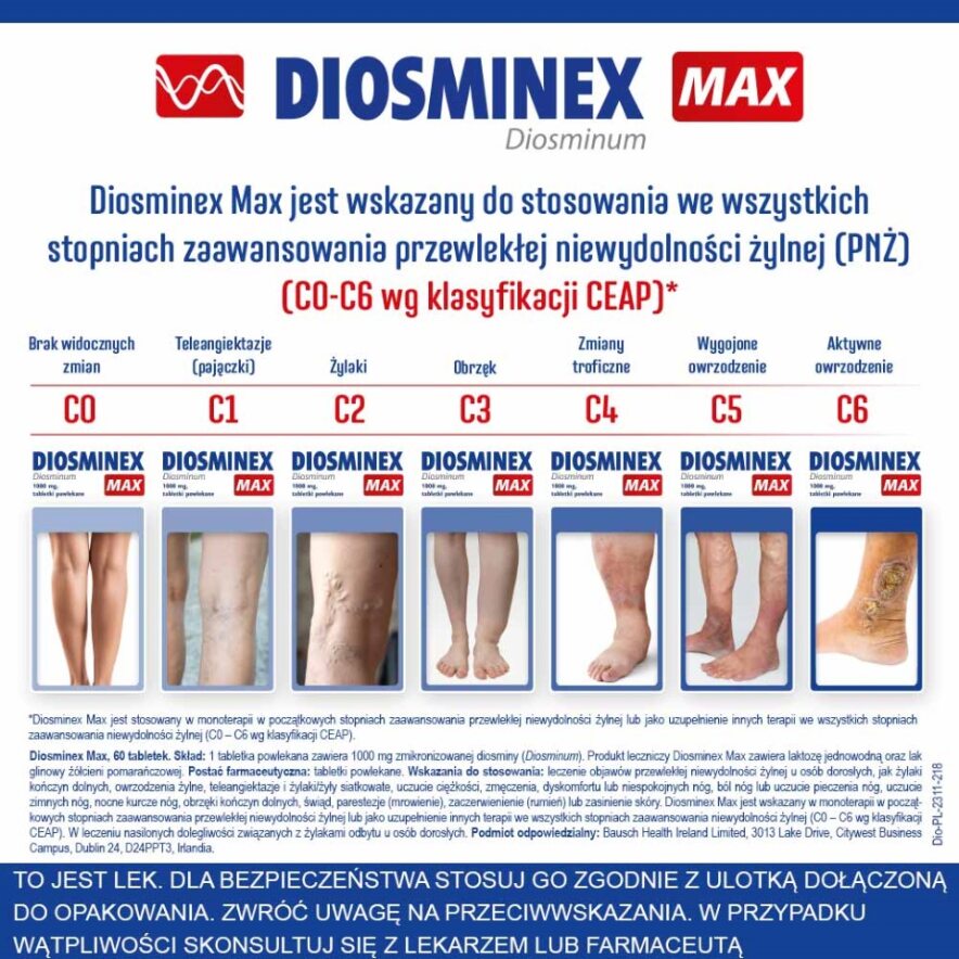 Diosminex Max, tabletki na uczucie ciężkich nóg oraz nocne skurcze,  60 szt.