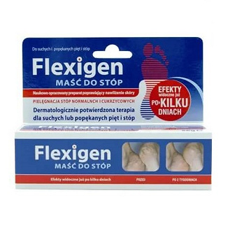Flexigen, maść do suchych i popękanych stóp, 56 g