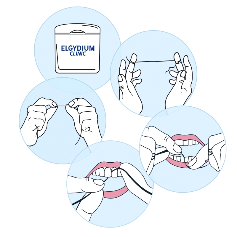Elgydium Clinic DentalFloss Crossing, nić dentystyczna do aparatów ortodontycznych i implantów