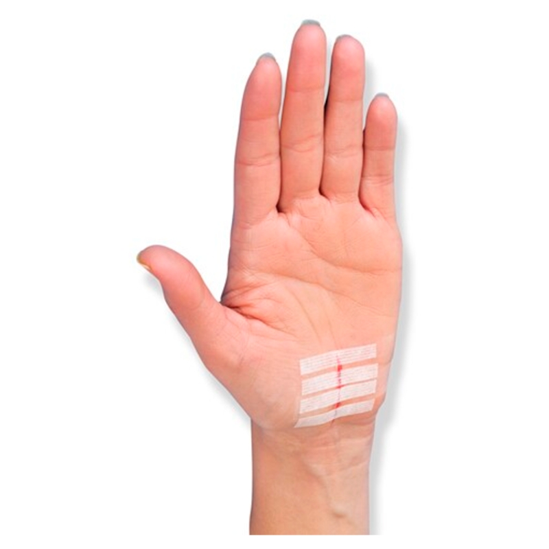 Steri Strip Paski do zamykania ran , białe: 3 x 75 mm - 5 szt. + 6 x 75 mm - 3 szt.