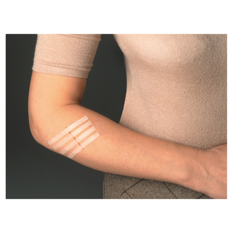 Steri Strip Paski do zamykania ran , białe: 3 x 75 mm - 5 szt. + 6 x 75 mm - 3 szt.