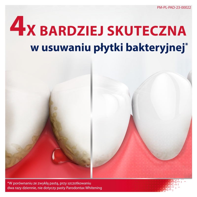 Parodontax Classic, pasta do zębów zapobiegająca krwawieniu dziąseł, tuba 75 ml