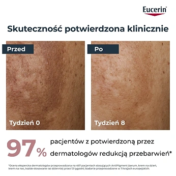 Eucerin Anti-Pigment, serum, 30 ml