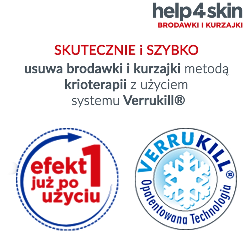 Help4skin, preparat do usuwania brodawek i kurzajek, 50 ml