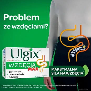 Ulgix wzdęcia, 80 mg 25 kapsułek