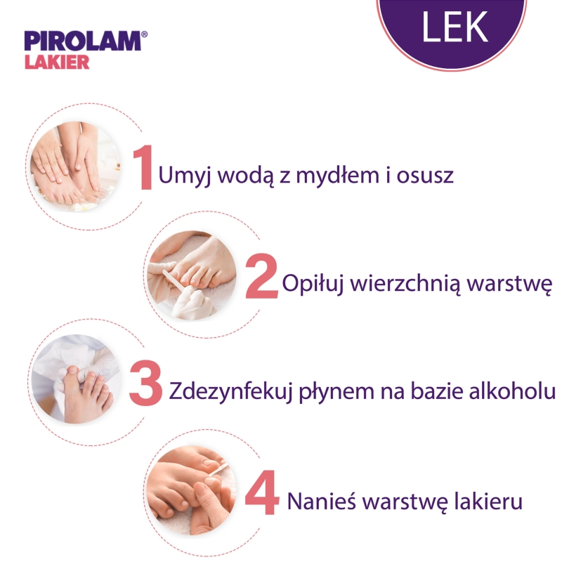 Pirolam Lakier, lakier leczniczy na grzybicę paznokci, butelka 4 g