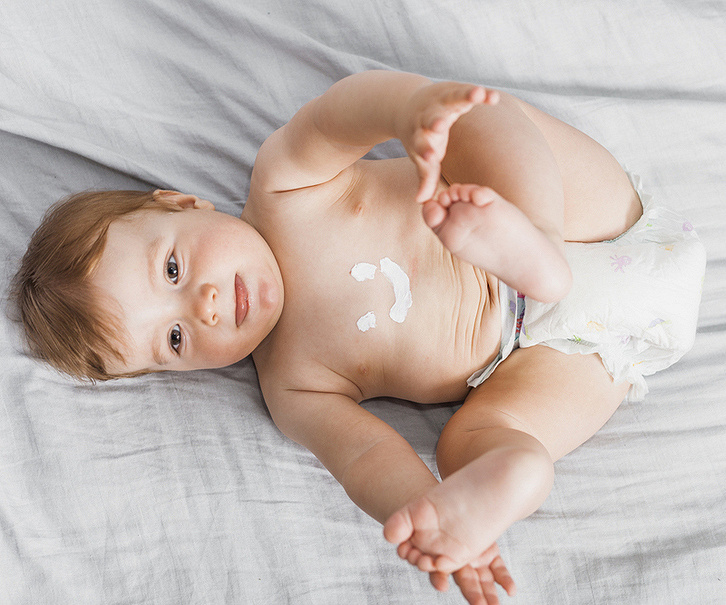 Atopowe zapalenie skóry u dzieci i niemowląt - objawy, przyczyny, leczenie. Czy można zapobiegać wystąpieniu AZS u dzieci?