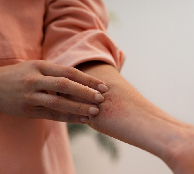 Alergia skórna: przyczyny, objawy i sposoby łagodzenia
